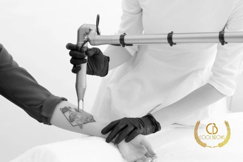 RESERVA ELIMINACION TATUAJES